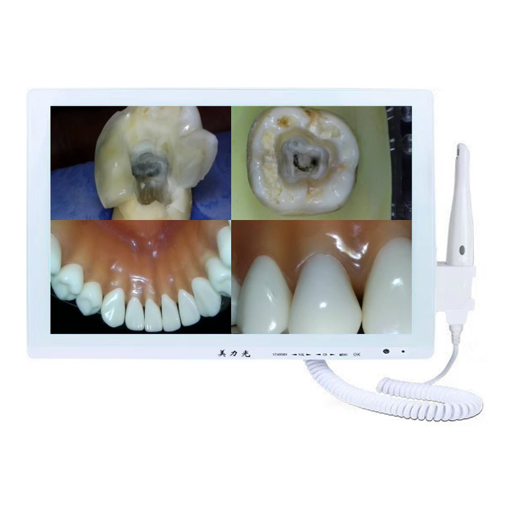 M-978 Wi-Fi智能变焦扫码17寸口腔观察仪一体机